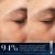 014-retinal-recharge--gallery.jpg