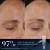 013-retinal-recharge--gallery.jpg